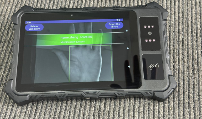 What is a palm vein scanner